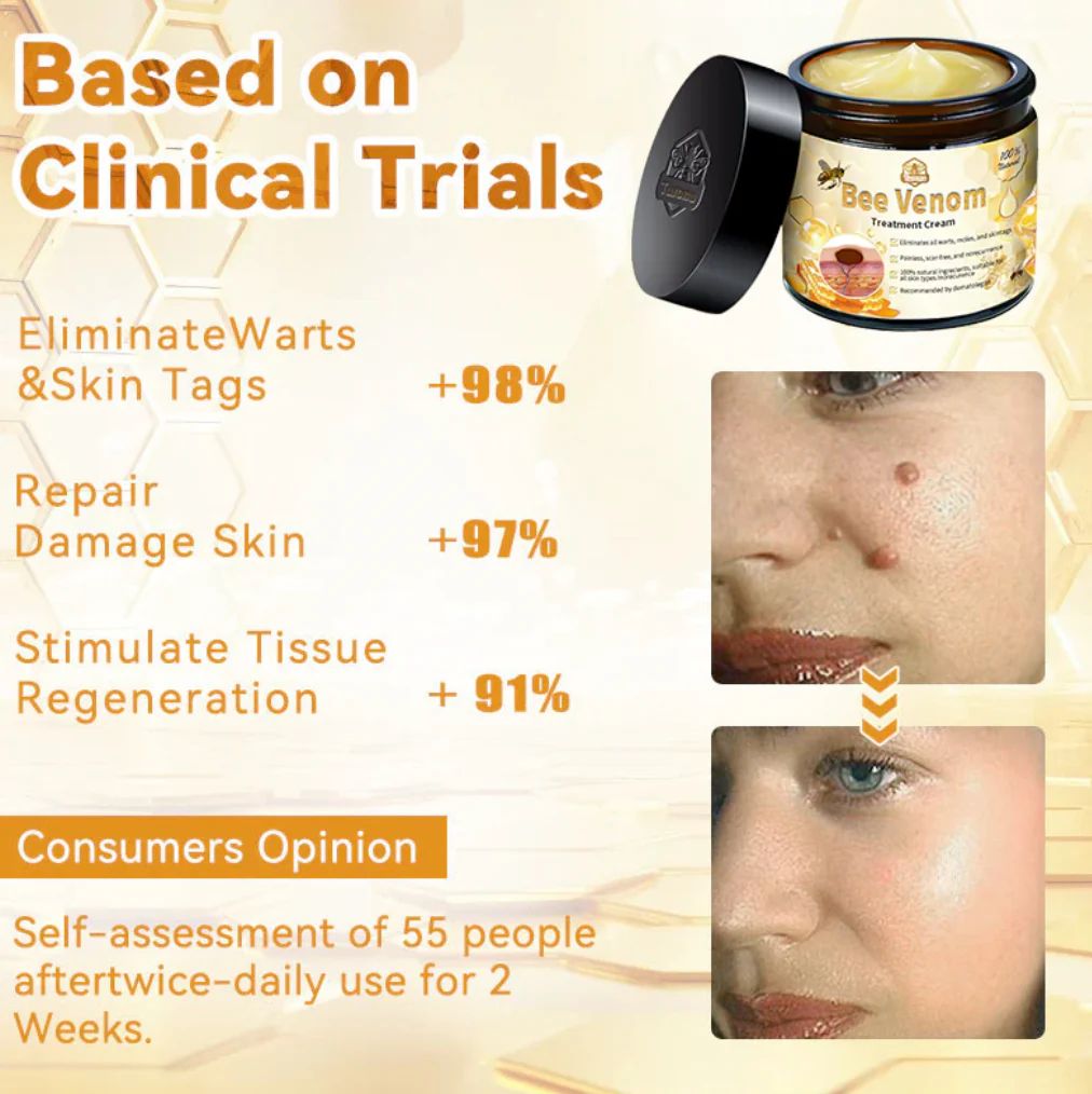 Bee Venam Wart & Mole Removel Cream