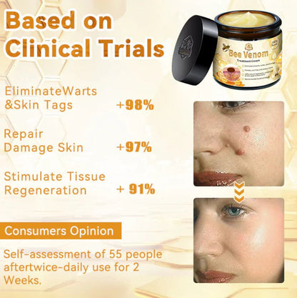 Bee Venam Wart & Mole Removel Cream
